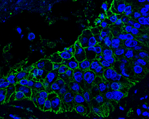 Anti-AXL antibody used in IHC (Paraffin sections) (IHC-P). GTX129407