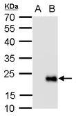 Anti-RGS19 antibody used in Western Blot (WB). GTX129412