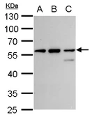 Anti-CLN3 antibody used in Western Blot (WB). GTX129457