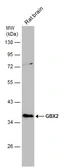 Anti-GBX2 antibody used in Western Blot (WB). GTX129494