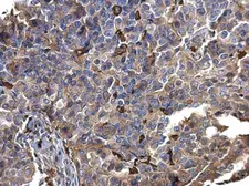 Anti-S100A9 antibody used in IHC (Paraffin sections) (IHC-P). GTX129575