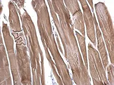 Anti-Elafin antibody used in IHC (Paraffin sections) (IHC-P). GTX129581