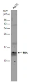 Anti-MIA antibody used in Western Blot (WB). GTX129590