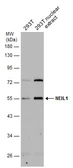 Anti-NEIL1 antibody used in Western Blot (WB). GTX129607