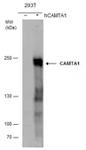 Anti-CAMTA1 antibody used in Western Blot (WB). GTX129686