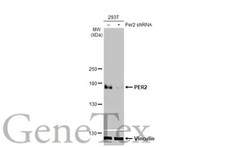 Anti-PER2 antibody used in Western Blot (WB). GTX129688