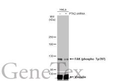 Anti-FAK (phospho Tyr397) antibody used in Western Blot (WB). GTX129840