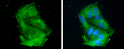 Anti-Apolipoprotein CIII antibody used in Immunocytochemistry/ Immunofluorescence (ICC/IF). GTX129994