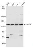 Anti-VPS18 antibody used in Western Blot (WB). GTX130176