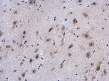 Anti-COL4A1 antibody used in IHC (Paraffin sections) (IHC-P). GTX130215