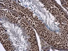 Anti-FOXO1 antibody used in IHC (Paraffin sections) (IHC-P). GTX130279