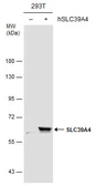 Anti-SLC39A4 antibody used in Western Blot (WB). GTX130285