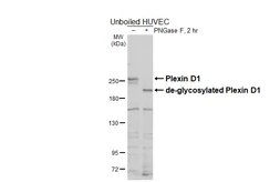 Anti-Plexin D1 antibody used in Western Blot (WB). GTX130372