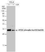 Anti-RPS6 (phospho Ser235/236) antibody used in Western Blot (WB). GTX130430