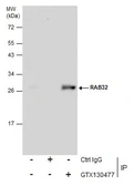 Anti-RAB32 antibody used in Immunoprecipitation (IP). GTX130477