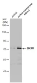 Anti-EDEM1 antibody used in Western Blot (WB). GTX130500
