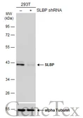 Anti-SLBP antibody used in Western Blot (WB). GTX130597