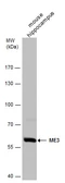 Anti-ME3 antibody used in Western Blot (WB). GTX130689