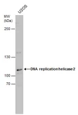 Anti-DNA replication helicase 2 antibody used in Western Blot (WB). GTX130713