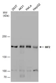 Anti-INF2 antibody used in Western Blot (WB). GTX130714