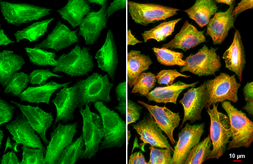 Anti-Plectin antibody used in Immunocytochemistry/ Immunofluorescence (ICC/IF). GTX130764