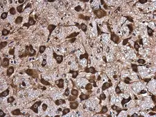 Anti-NMT1 antibody used in IHC (Paraffin sections) (IHC-P). GTX130852