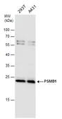 Anti-PSMB1 antibody used in Western Blot (WB). GTX130875