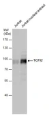 Anti-TCF12 antibody used in Western Blot (WB). GTX130901