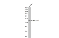 Anti-SLC19A2 antibody used in Western Blot (WB). GTX131042