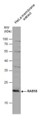 Anti-RAB18 antibody used in Western Blot (WB). GTX131055