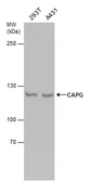 Anti-HCAP-G antibody used in Western Blot (WB). GTX131128