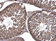 Anti-DHX36 antibody used in IHC (Paraffin sections) (IHC-P). GTX131179