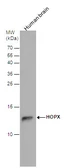 Anti-HOPX antibody used in Western Blot (WB). GTX131224