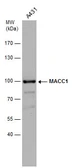 Anti-MACC1 antibody used in Western Blot (WB). GTX131332