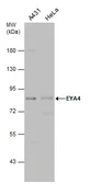 Anti-EYA4 antibody used in Western Blot (WB). GTX131408
