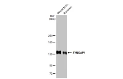 Anti-SYNGAP1 antibody used in Western Blot (WB). GTX131673