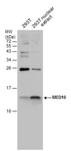 Anti-MED10 antibody used in Western Blot (WB). GTX131860