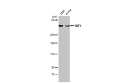 Anti-RIF1 antibody used in Western Blot (WB). GTX131889