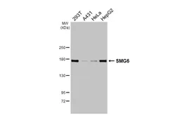Anti-SMG6 antibody used in Western Blot (WB). GTX131919