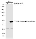 Anti-West Nile virus Envelope antibody used in Western Blot (WB). GTX132052
