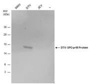 Anti-Powassan virus prM protein antibody used in Western Blot (WB). GTX132055