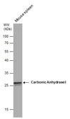 Anti-Carbonic Anhydrase 1 antibody used in Western Blot (WB). GTX132070