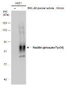 Anti-Paxillin (phospho Tyr31) antibody used in Western Blot (WB). GTX132154
