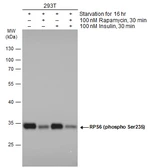 Anti-RPS6 (phospho Ser235) antibody used in Western Blot (WB). GTX132281