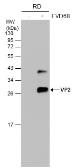Anti-Enterovirus D68 VP2 antibody used in Western Blot (WB). GTX132314