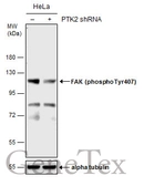 Anti-FAK (phospho Tyr407) antibody used in Western Blot (WB). GTX132320