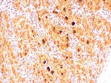 Anti-Enterovirus 71 2B antibody used in IHC (Paraffin sections) (IHC-P). GTX132343