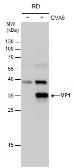 Anti-Coxsackievirus A6 VP1 antibody used in Western Blot (WB). GTX132346
