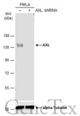 Anti-AXL antibody used in Western Blot (WB). GTX132386