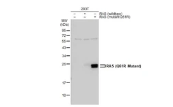 Anti-RAS (Q61R Mutant) antibody used in Western Blot (WB). GTX132406